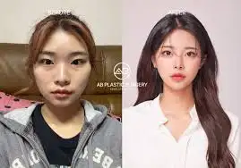 Khám phá sức mạnh của kem dưỡng da từ nghệ cho làn da rạng rỡ!